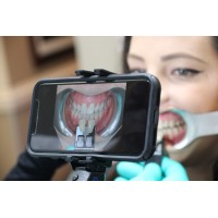 ShadeWave Mobile Dentist